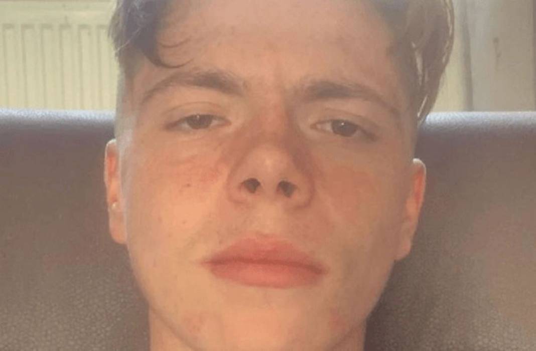 Bu otun sadece yanından geçti, hayatı karardı! Bir ömür onunla yaşayacak, kabus gibi 1